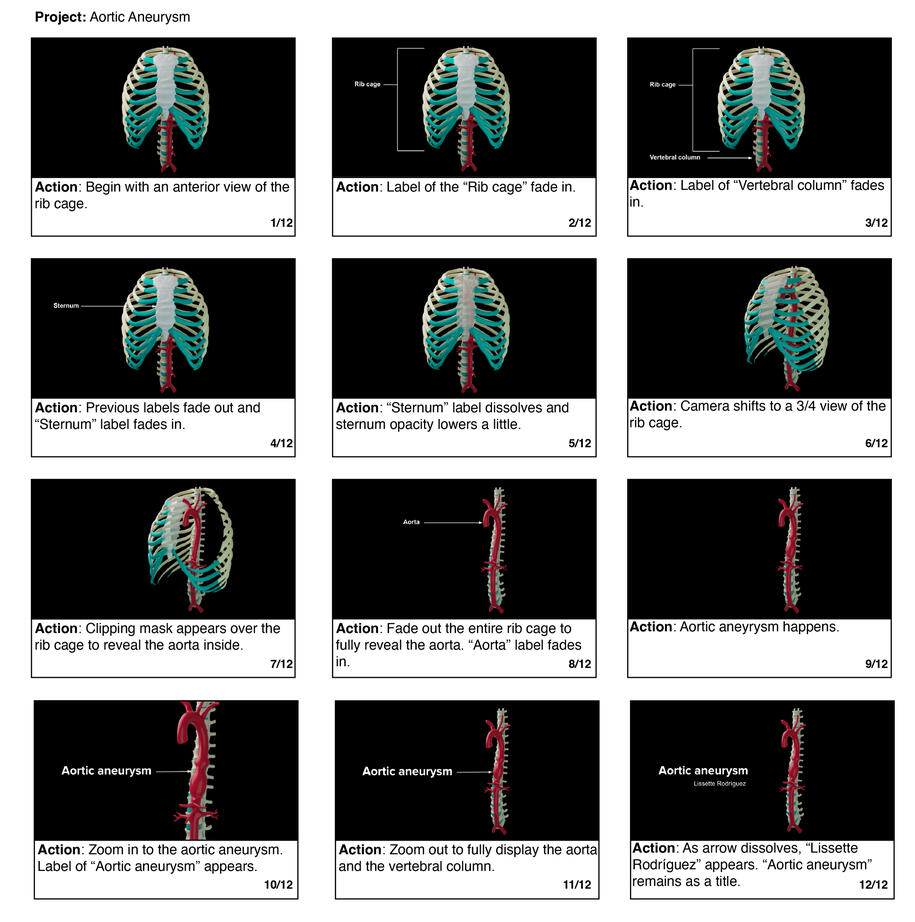 Aortic aneurysm storyboards 1 – Autodesk Maya, Adobe Illustrator
